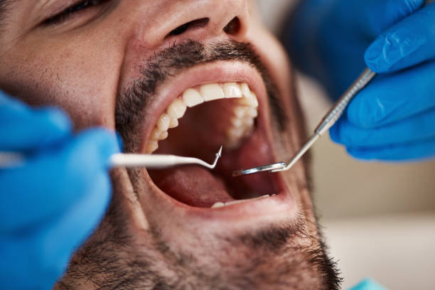 Best Emergency Treatment for Toothache in Huntgburg, IN